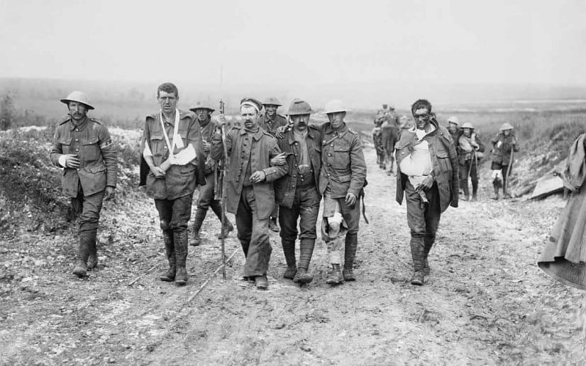 L'”imbecillità” della guerra